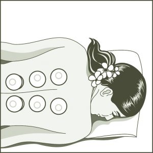 hijama sur une femme pour soigner ses douleurs du dos